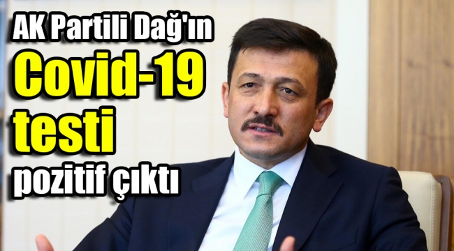 AK Partili Dağ'ın Covid-19 testi pozitif çıktı