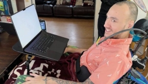 Beyin çipine 21 gönüllü